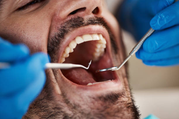 Best Emergency Treatment for Toothache in Mcsherrystown, PA